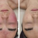 Skin이야기