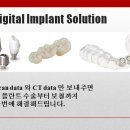 리더스덴탈 네이버블로그