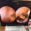 오티콘보청기 신촌센터 해피히어링 이미지