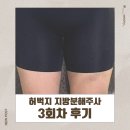 좋은의원 | 상상보다 효과 좋은 허벅지 지방분해주사 부산 다이어트 의원 방문 3회차 후기