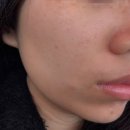 문라이트(Moon Light) | 청주 오송역 | 얼굴윤곽 피부 탄력 추천 문라이트 뷰티 알테온 후기