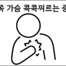 왼쪽 가슴 콕콕찌르는 증상 이미지
