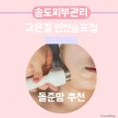 씨유 송도더프라우점 | 송도 피부관리 고은결 인천송도점에서 신부관리 받은 후기 - 돌준맘추천