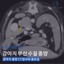 부신메디칼 이미지