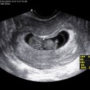 큰곰약국 이미지