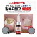 미라클 네일