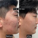 [공지] 셀비아 앰플 내돈내산 솔직후기! 효과 볼 수 밖에 없는 이유