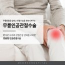 무릎인공관절수술 부담갖지 마세요! 이미지