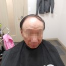 대전가발 어색함 1도 없는 자연스러운 스타일