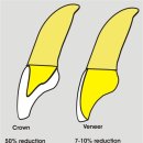 임프란트(Implant) &amp; 라미네이트(Veneer) 전문병원 김민석 치과 이미지