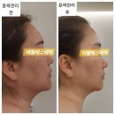 피부시술전 반드시 지켜야할 준비 10회로 끝내자.진영 더웰에스테틱