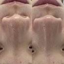 모모스왁싱 | [모공팩 조합] 비반콴트망카로션 악센다 루티너 기미 모공 삭제밤 내돈내산 후기