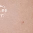 쁘띠365의원 이미지