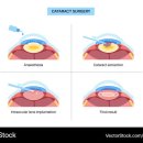 센텀성모안과의원 이미지