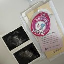 (주)미리본 | [38주0일] 일란성 쌍둥이 열달기록 및 동탄제일병원 제왕절개 후기!