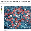 '원숭이 두창 비상사태 선포' 블랙스완 징후가 나오네요. 이미지