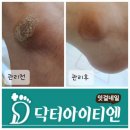 잇걸네일