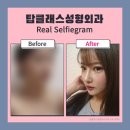 탑클래스성형외과의원 네이버블로그