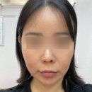 미가람부부한의원 | 춘천 한의원 미가람부부한의원 라보센 바이오 좀 스킨