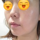 금손풋샵 | 차이나풋샵(인천중구)마이크로젯 레이저