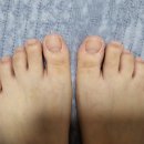 케어: 화양연화 이미지