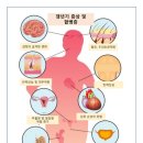 에스테라 이미지