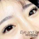 아이앤라나