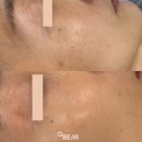 올리하이 이미지