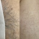 티나뷰티 - 천안시 서북구 서부12길 15-1 | 병점왁싱 강력추천 온뷰티왁싱티나 왁싱솔직후기