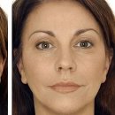 피오라의원 이미지