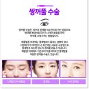 제이영의원 | 해운대쌍꺼풀 자연스러운 이뻐지자!