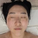 청초에스테틱 | 원흥 피부관리 청초한스킨케어 에스테틱에서 윤곽 관리 받아 본 후기