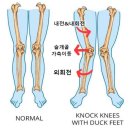 서울 한남동 교정운동 전문 파프짐 한남점 무릎 재활 운동