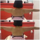 라인플레이(주) | 대전 송촌동피부관리실 플레이스킨에서 온다웨이브 팔뚝관리 받고 온 후기