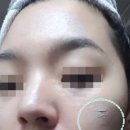 크린피부과