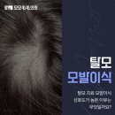 연예인모발이식 자연스럽고 감쪽같은 결과로