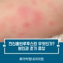 류마박원내과의원 네이버블로그