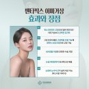 엔도픽스 이미지