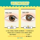 명지성모안과의원 네이버블로그