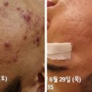 티나 에스테틱 이미지