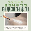 논현2-111 | 결혼 전 타투제거후기｜신논현 클린타투의원 레터링 타투제거 2회차