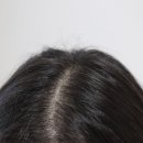 현대환경㈜ | 마이녹셀 스피큘 탈모앰플 사용해본 후기