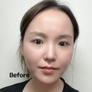 코오롱유통(주)명동점 | 효소파우더 모공팩 아포테 튤립알엑스 PDRN 파우더 클렌저 후기