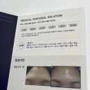 필클래식 | 오창피부관리 오로라뷰티 연예인필링 PHA 물톡스 클래식 후기