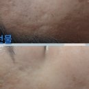 308뷰티