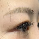 눈, 여기다 이미지