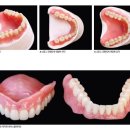 덴탈리아치과기공소 | [보도자료] 글로벌임상 - 파트너십으로 함께 작업하는 덴쳐 제작 시스템