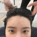 웰킨두피미금점 | 용인 수지 웰킨 두피탈모센터 파워디톡스 스케일링 내돈내산 후기