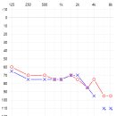 청음 독일보청기 이미지
