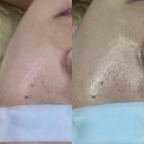 개봉푸르지오 정문 | 개봉동 뷰티스킨케어 광채테라피 후기